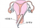 了解剖腹产后的经阴道分娩